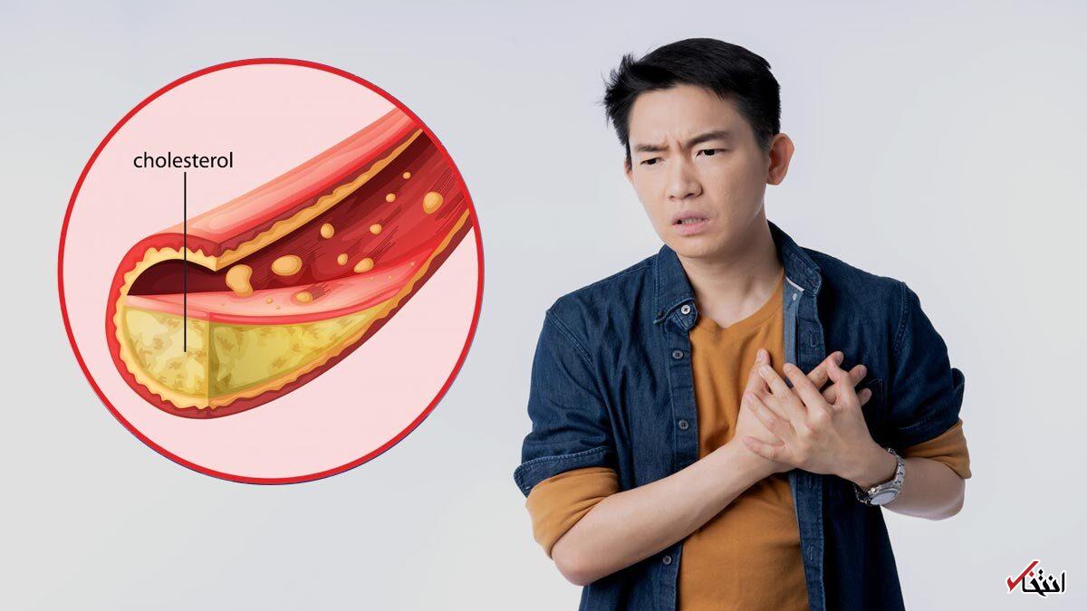 چگونه خشکبار به مدیریت کلسترول کمک می‌کند؟