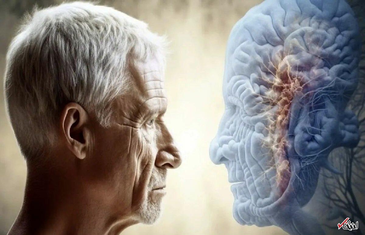 تغییر سبک زندگی می‌تواند سلامت مغز را در سالمندان بهبود دهد