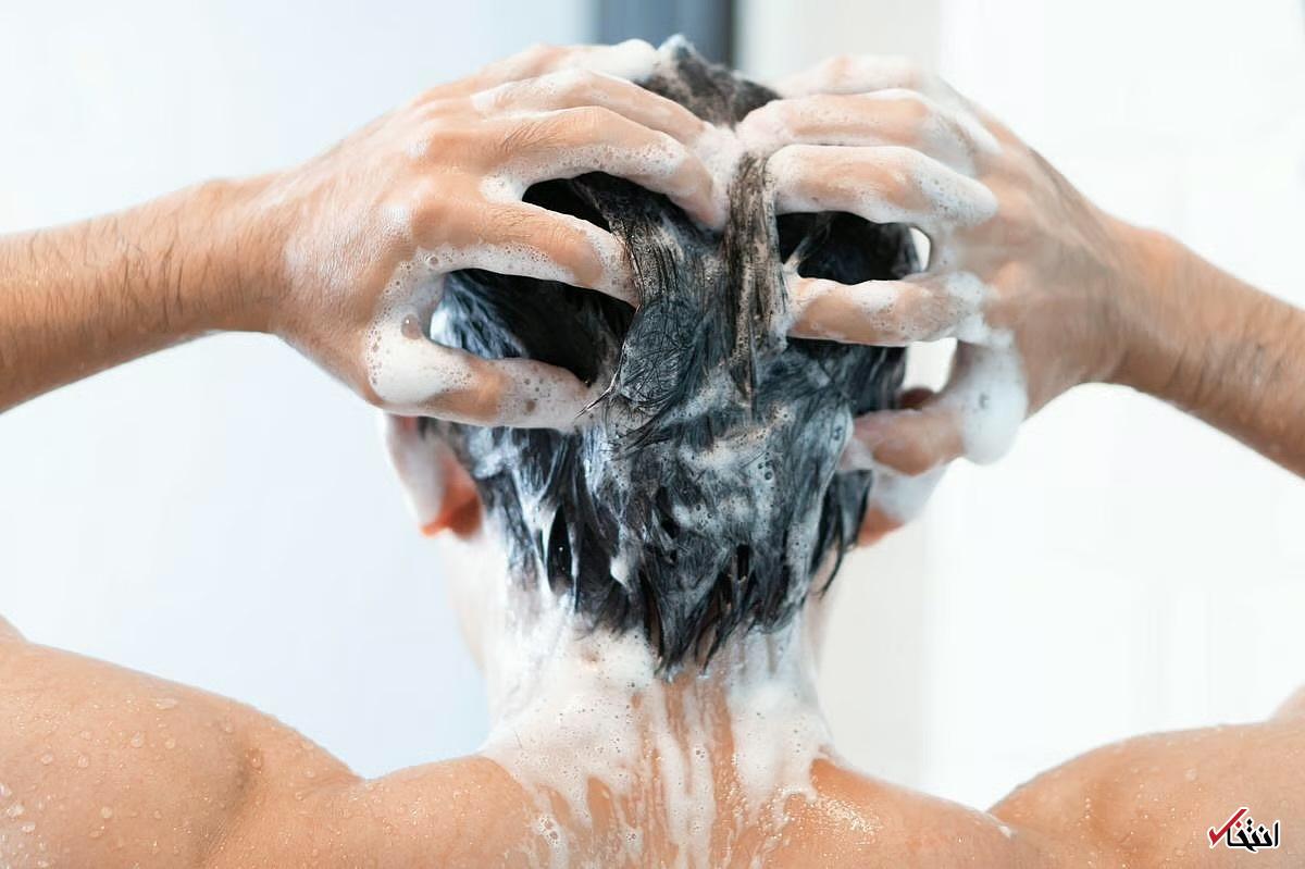 ژل جدید ممکن است به پیشگیری از ریزش مو در طول شیمی‌درمانی کمک کند