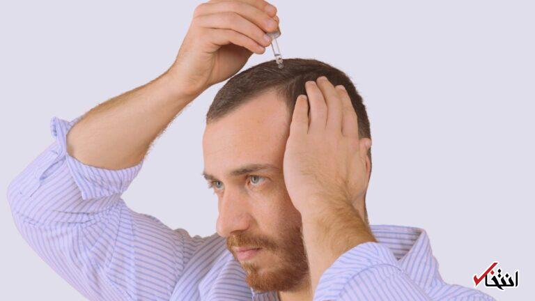 شیرین‌کننده‌ی طبیعی اثر یکی از درمان‌های رایج ریزش مو را تقویت می‌کند