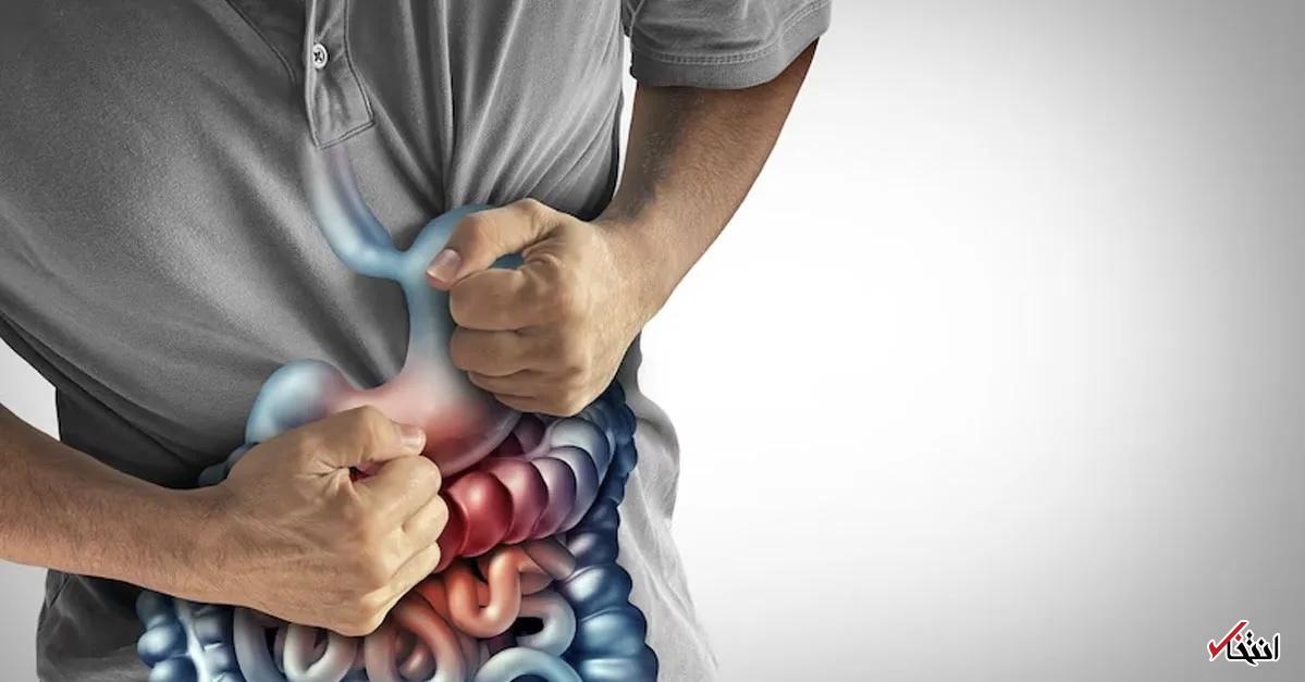آیا بیماری التهابی روده‌ی شما واقعاً ناشی از استرس است؟