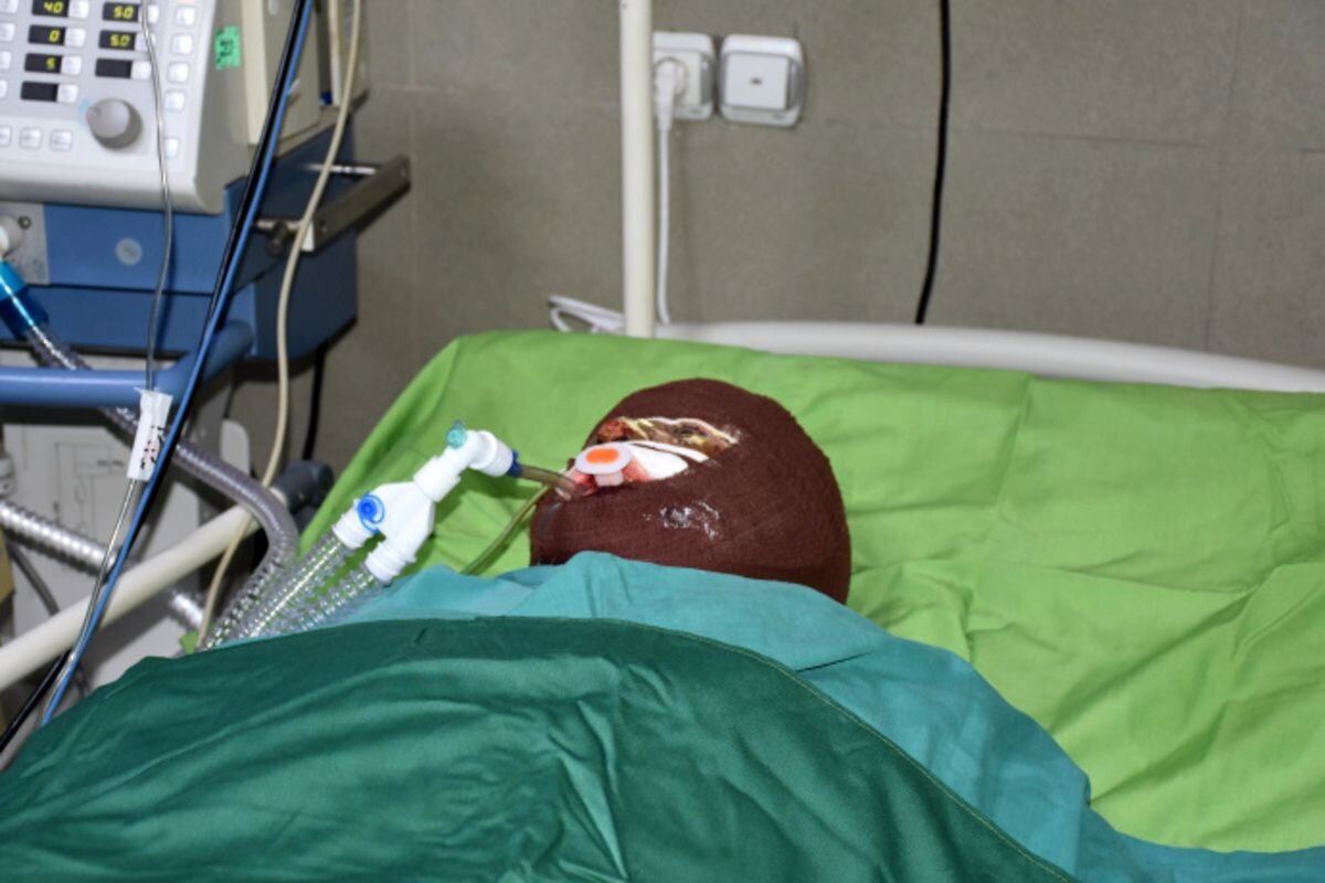 اسیدپاشی هولناک روی پدر و دختر / انگیزه همسایه اسیدپاش چه بود؟