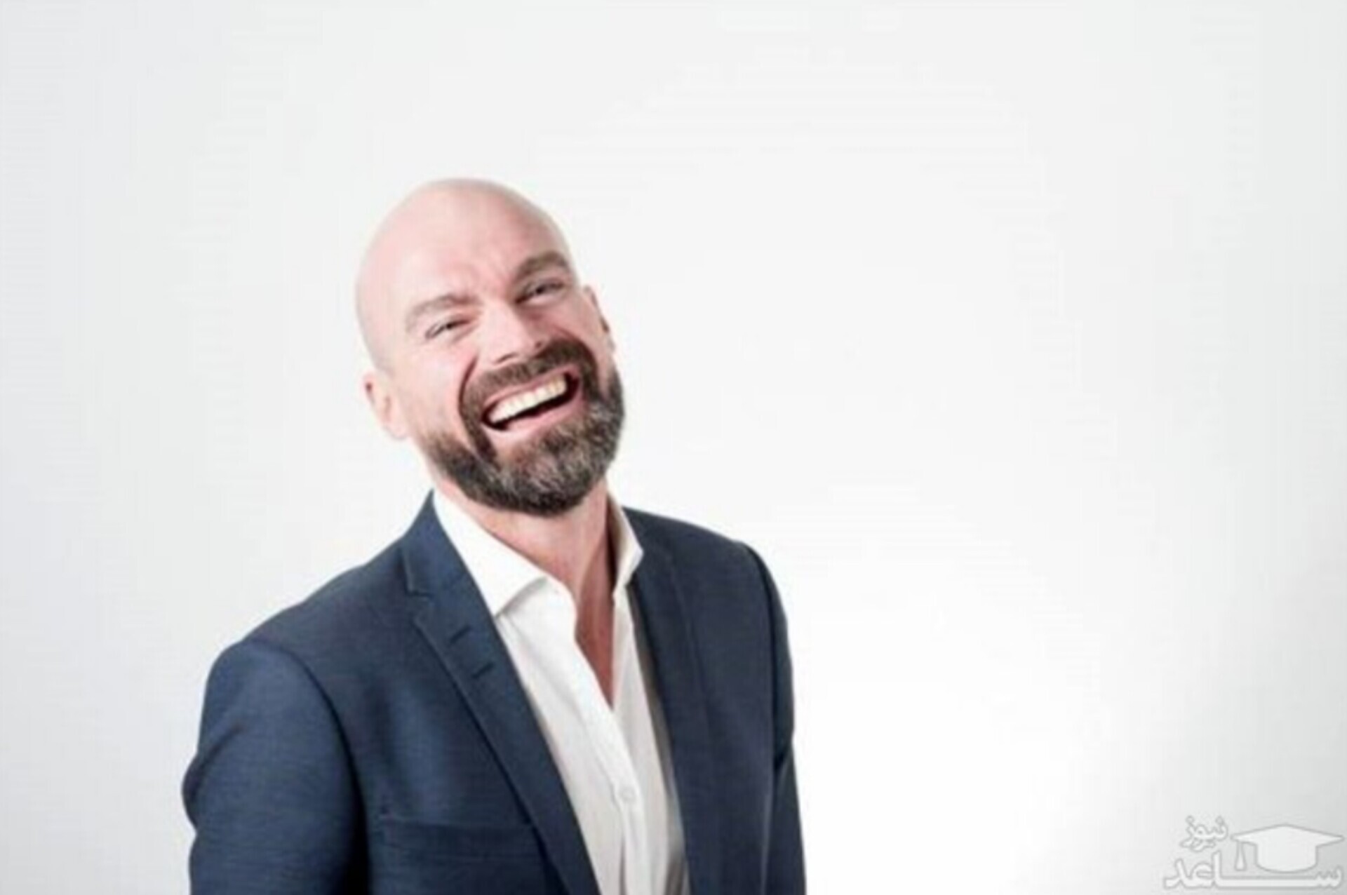 خبر خوب برای کچل‌ها: دارویی جدید در آزمایش‌ها باعث افزایش ۵۳۹ درصدی رشد مو شد